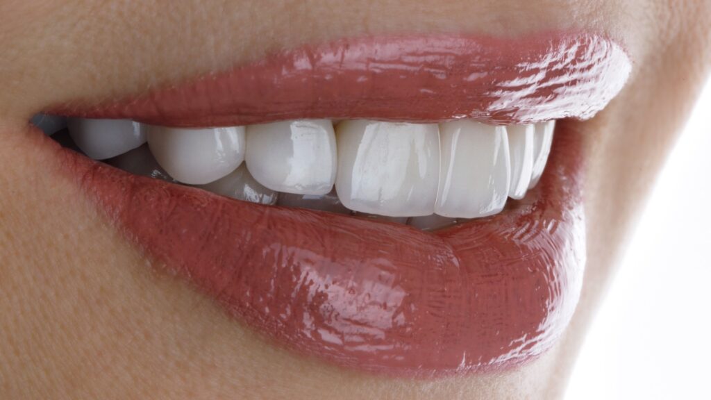 Contorneado dental